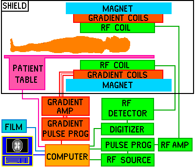 Emi ct scanner essay